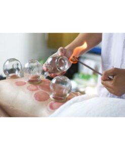 [Udemy Course] Professional Fire Cupping Therapy Course Certificate by Manik Miah