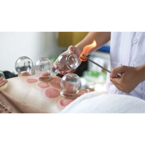 [Udemy Course] Professional Fire Cupping Therapy Course Certificate by Manik Miah